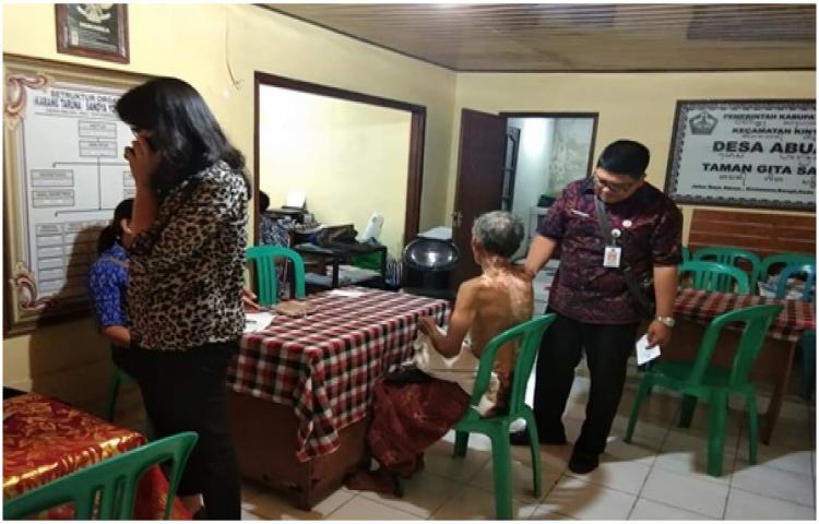 Penanganan Penyakit Kusta di Kabupaten Bangli